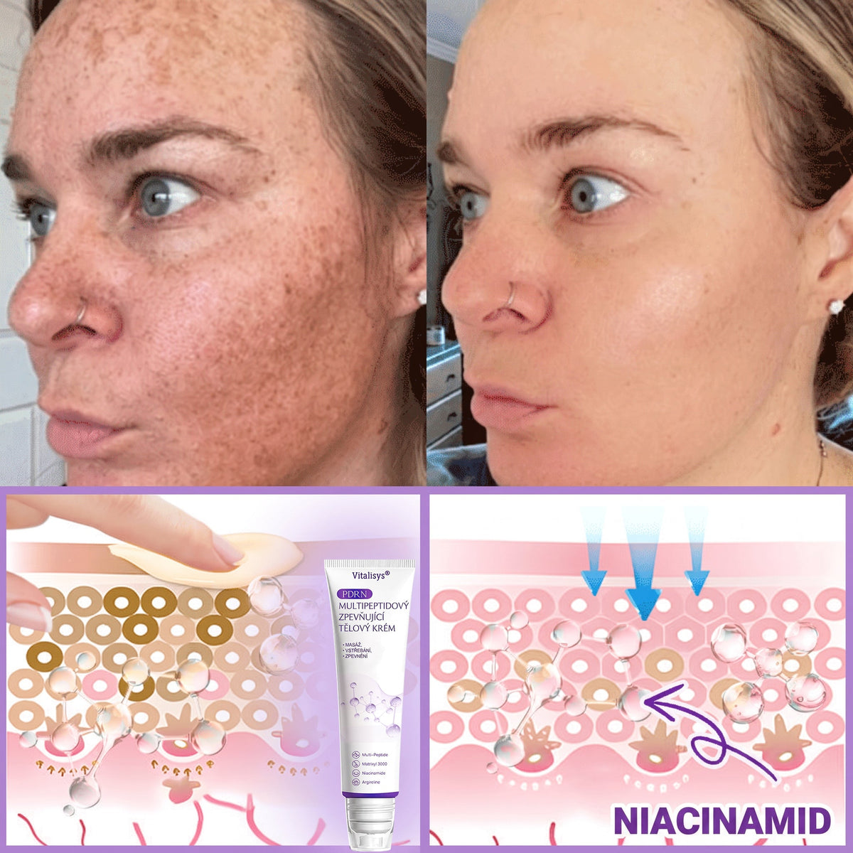 Vitalisys®🔥PDRN Multi-Peptide Masážní tělový krém s válečkem — proti stárnutí, hydratuje, zpevňuje a liftinguje pokožku, podporuje regeneraci, sjednocuje tón pleti a pečuje o nedokonalosti a tmavé skvrny.