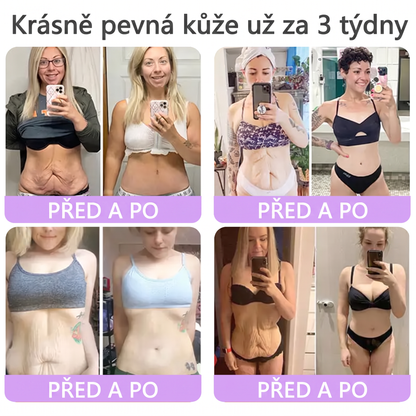 Vitalisys®🔥PDRN Multi-Peptide Masážní tělový krém s válečkem — proti stárnutí, hydratuje, zpevňuje a liftinguje pokožku, podporuje regeneraci, sjednocuje tón pleti a pečuje o nedokonalosti a tmavé skvrny.