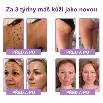 Vitalisys®🔥PDRN Multi-Peptide Masážní tělový krém s válečkem — proti stárnutí, hydratuje, zpevňuje a liftinguje pokožku, podporuje regeneraci, sjednocuje tón pleti a pečuje o nedokonalosti a tmavé skvrny.