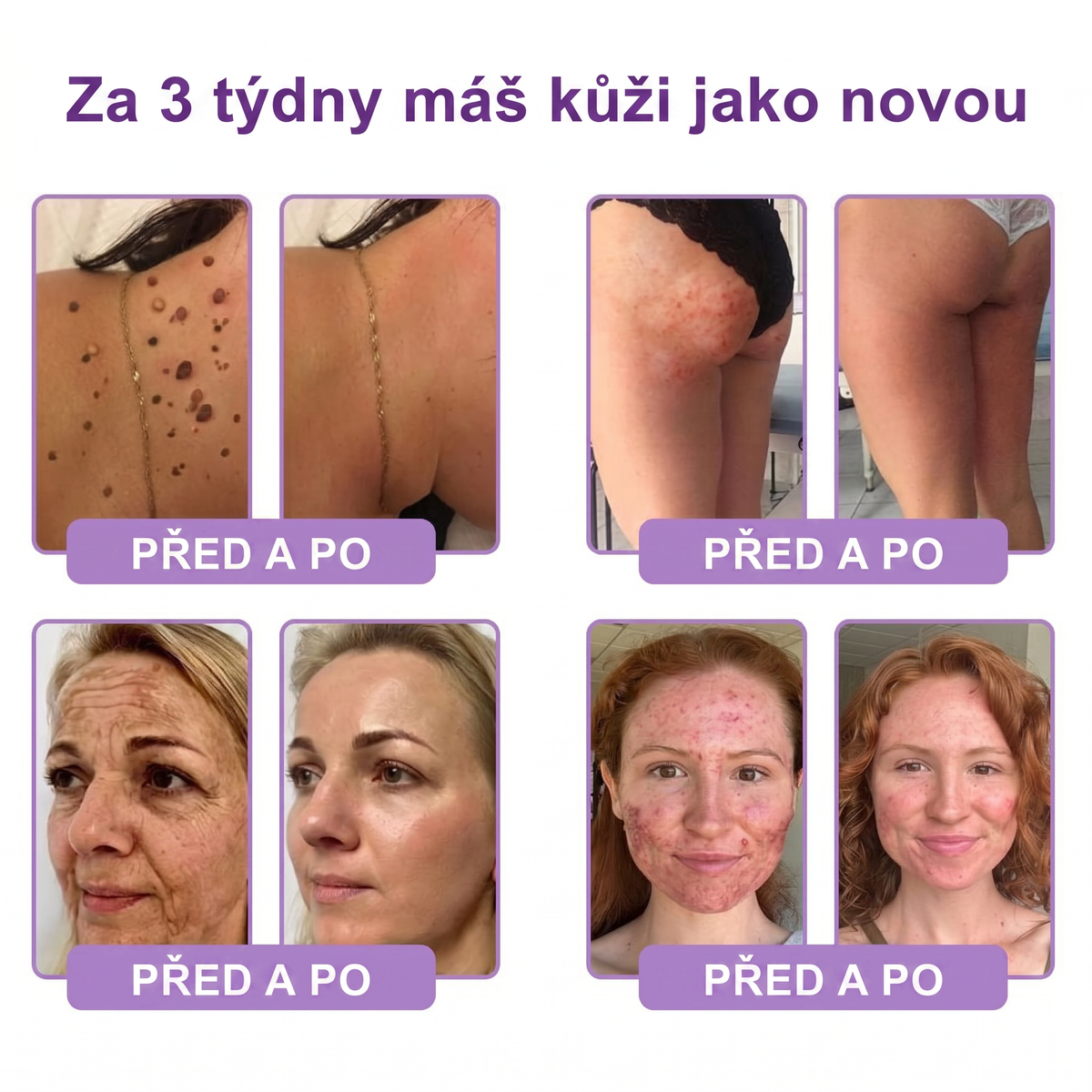Vitalisys®🍃PDRN Multi-Peptide Masážní tělový krém s válečkem — proti stárnutí, hydratuje, zpevňuje a liftinguje pokožku, podporuje regeneraci, sjednocuje tón pleti a pečuje o nedokonalosti a tmavé skvrny.