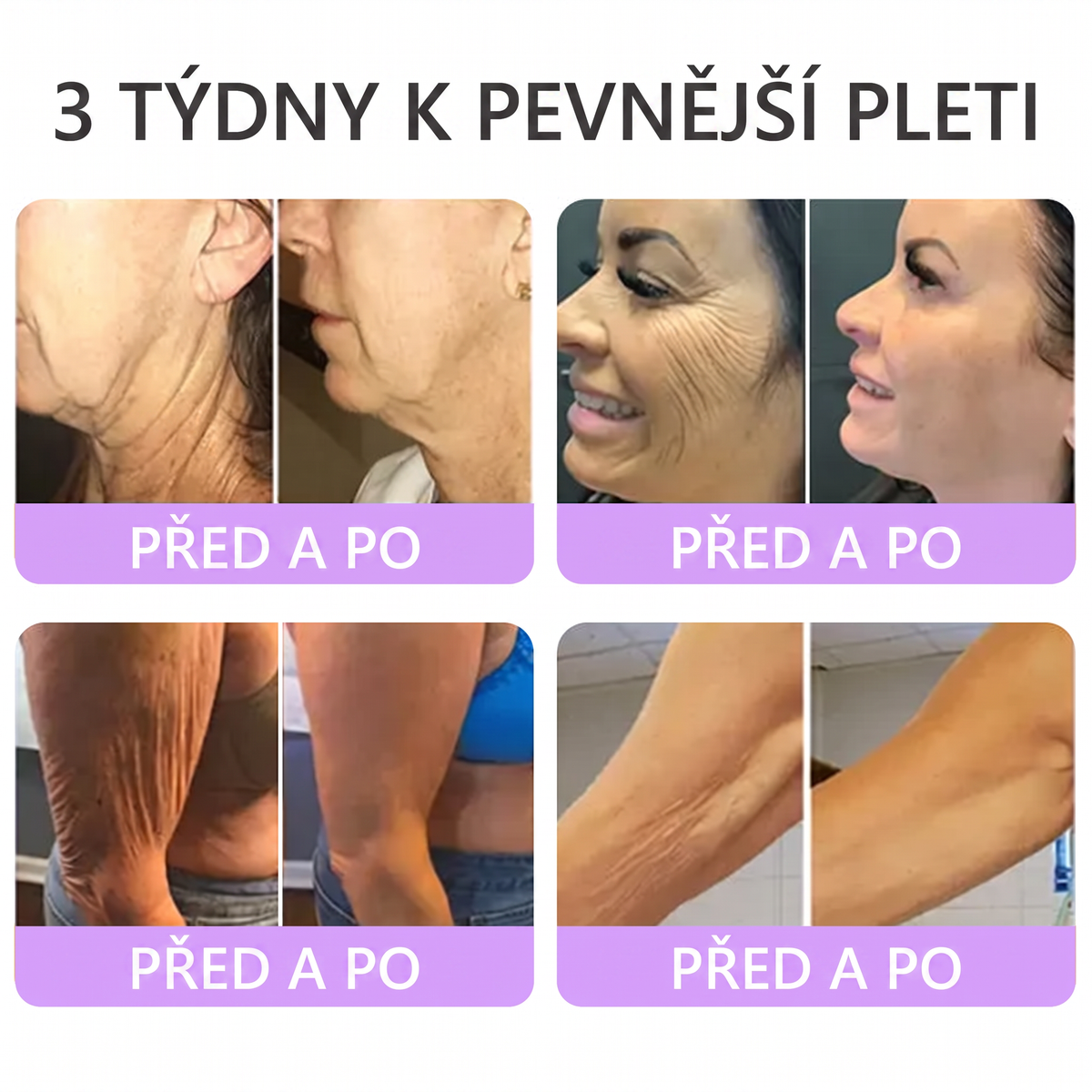 Vitalisys®🍃PDRN Multi-Peptide Masážní tělový krém s válečkem — proti stárnutí, hydratuje, zpevňuje a liftinguje pokožku, podporuje regeneraci, sjednocuje tón pleti a pečuje o nedokonalosti a tmavé skvrny.