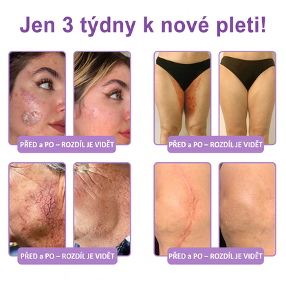 Vitalisys®🍃PDRN Multi-Peptide Masážní tělový krém s válečkem — proti stárnutí, hydratuje, zpevňuje a liftinguje pokožku, podporuje regeneraci, sjednocuje tón pleti a pečuje o nedokonalosti a tmavé skvrny.