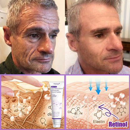Vitalisys®🔥PDRN Multi-Peptide Masážní tělový krém s válečkem — proti stárnutí, hydratuje, zpevňuje a liftinguje pokožku, podporuje regeneraci, sjednocuje tón pleti a pečuje o nedokonalosti a tmavé skvrny.